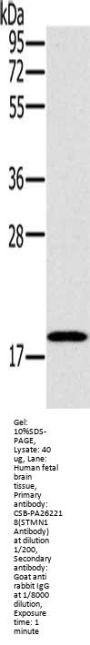Rabbit anti-human STMN1 polyclonal antibody