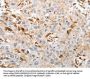 SLC15A2 Antibody