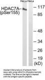 Phospho-HDAC7 (Ser155) Antibody