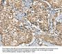 SGPL1 Antibody