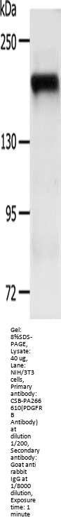 PDGFRB Antibody