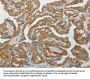 PADI4 Antibody