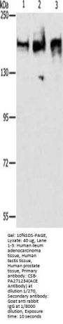ACE Antibody