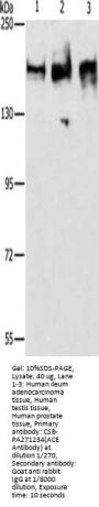ACE Antibody