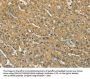S100A6 Antibody