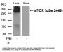 Phospho-MTOR (Ser2448) Antibody