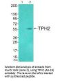 TPH2 (Ab-19) Antibody