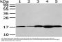 VAMP2 Antibody