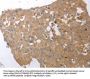 SIRT5 Antibody