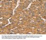 TGFB2 Antibody