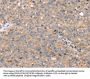 TGFB2 Antibody
