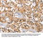 DKK3 Antibody