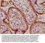 PSG9 Antibody