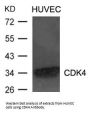 CDK4 Antibody