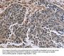 PNPT1 Antibody
