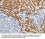 SLC5A5 Antibody