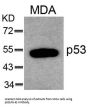 TP53 (Ab-6) Antibody