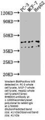 RHBDD3 Antibody