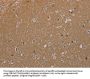 Rabbit anti-human MAGEL2 polyclonal antibody