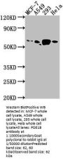 PDE1B Antibody