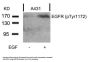 Phospho-EGFR (Tyr1172) Antibody