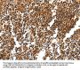 HDAC1 Antibody