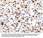 HDAC1 Antibody