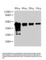 Met Antibody