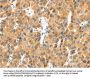 MACC1 Antibody