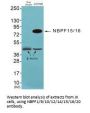 NBPF1/NBPF9/NBPF10/NBPF12/NBPF14/NBPF15/NBPF16/NBPF20 Antibody