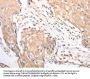 RAD52 Antibody