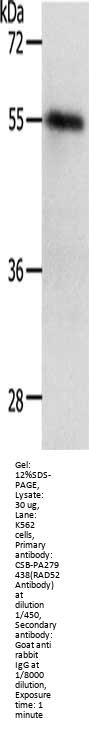 RAD52 Antibody