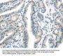 VLDLR Antibody