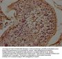 TRAPPC8 Antibody