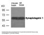 SYT1 (Ab-309) Antibody