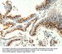 TRPC6 Antibody