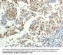 TRPC6 Antibody