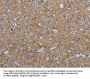 PGLYRP1 Antibody