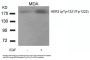 Phospho-ERBB2 (Tyr1221/Tyr1222) Antibody
