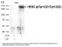 Phospho-ERBB2 (Tyr1221/Tyr1222) Antibody