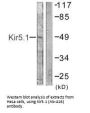 KCNJ16 (Ab-416) Antibody