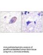KCNJ16 (Ab-416) Antibody