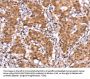 AMER1 Antibody