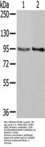 NUP98 Antibody