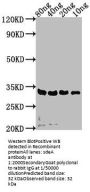 sdeA Antibody