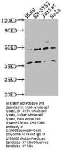 CASTOR2 Antibody