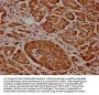 CDK17 Antibody