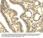 UHRF1BP1 Antibody