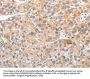CDR2 Antibody