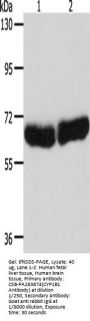 CYP1B1 Antibody